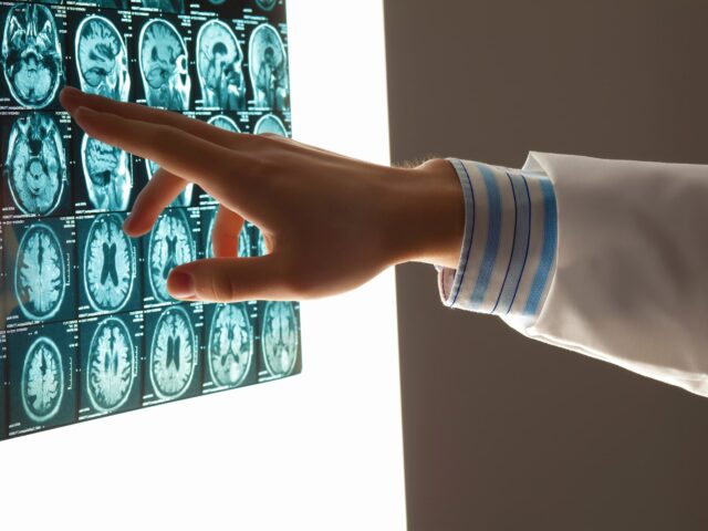 Your Legal Options After A Traumatic Brain Injury